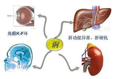 人体微量元素检测仪数据能够准检测出但身体中微量元素铜超标会引起疾病发生 人体微量元素检测仪数据能够准检测出但身体中微量元素铜超标会引起疾病发生